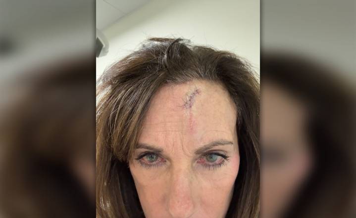 Tourist describes harrowing attack by homeless man arrested for assault on NYU student