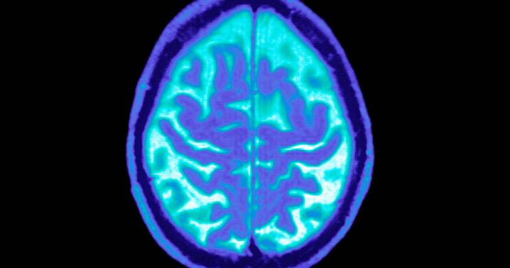 Novo Nordisk still sees potential in Ozempic for Alzheimer’s, despite trial setbacks