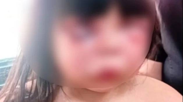 Vecinos detuvieron a un hombre que desfiguró a golpes a su hijastra de 7 años
