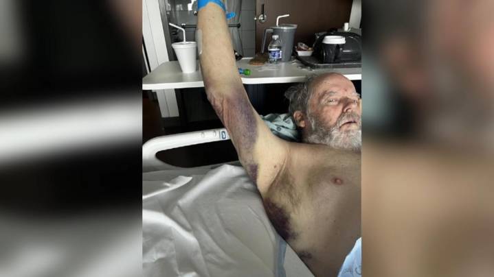 'How could you do that to an elderly person': 73-year-old man with dementia attacked by hospital worker at HCA Orange Park, family demands answers