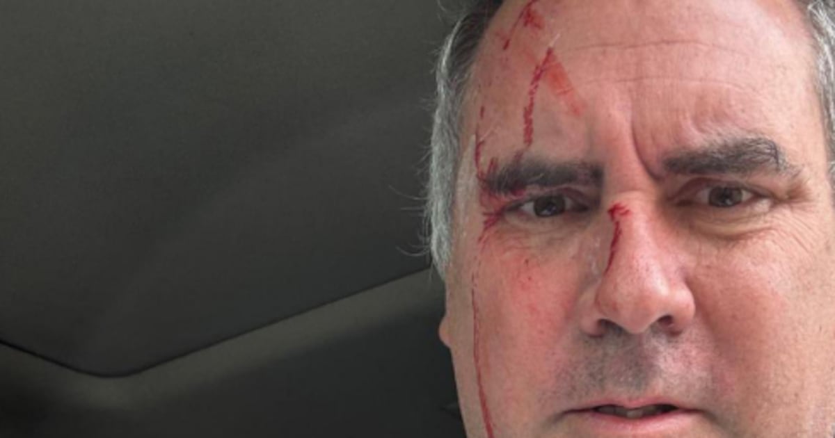 Atacan a Rafael Belaúnde precandidato presidencial de Perú; dispararon tres veces al parabrisas