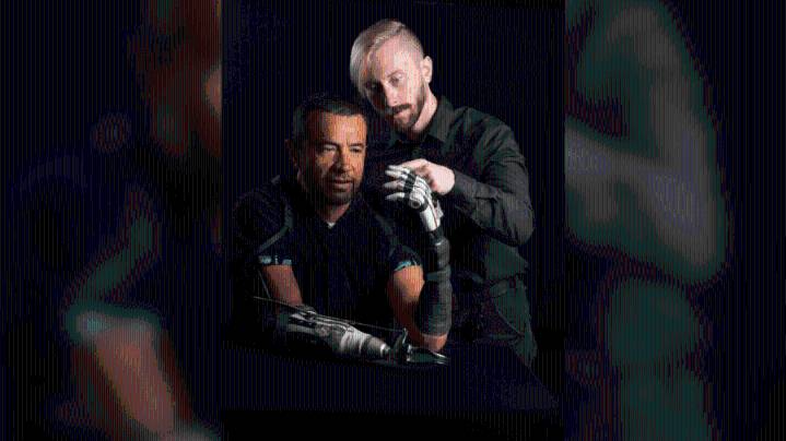 New AI prosthetic hand learns to grasp objects like a human, Utah researchers report