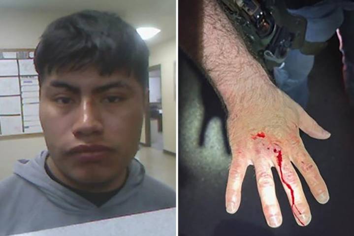Illegal immigrant bites ICE officer, draws blood while resisting arrest in Tullos, Louisiana
