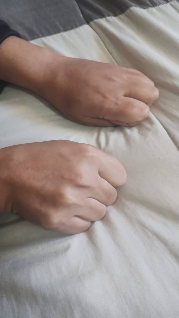 Denuncian mala práctica de paramédicos