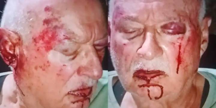 Violenta entradera en Mar del Plata: un grupo de delincuentes atacó a golpes y le robó a una pareja de jubilados