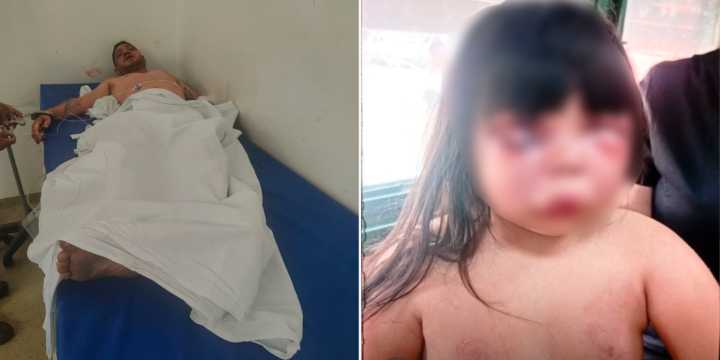 Un hombre le desfiguró la cara a golpes a una nena de 7 años, atacó a la madre y fue detenido por vecinos en Gerli