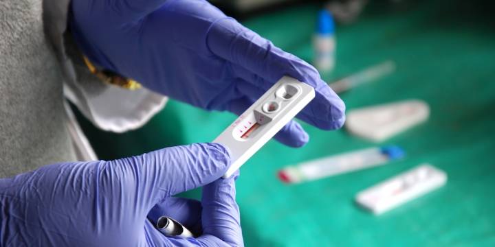 Ministerio de Salud respondió denuncias de aumento de infecciones por VIH en Colombia