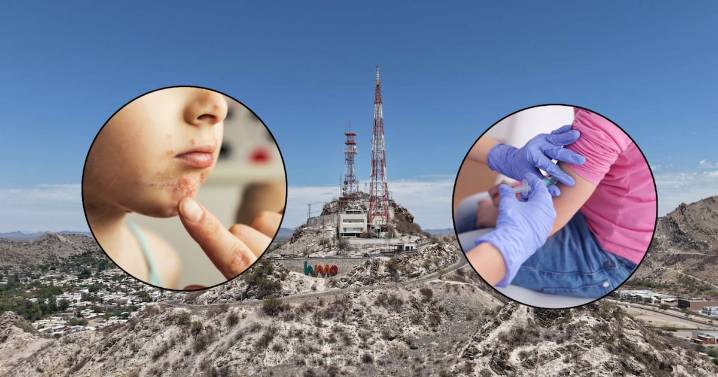 Padres de familia de la Secundaria Técnica Número 72 decidieron no enviar a sus hijos tras un brote de varicela; entre 20 y 30 alumnos se contagiaron en la última semana