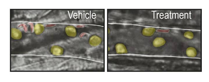 Científicos descubren por qué los infartos son menos dañinos por la noche