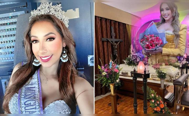 Muere Raquel Escalante, exreina de belleza, tras luchar contra el cáncer