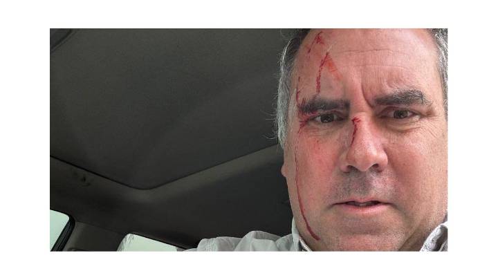 Perú: balearon al candidato presidencial Rafael Belaunde Llosa