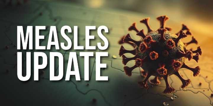 Two cases of measles reported in Williams County