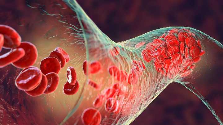 There's A Better Clot-Preventing Option Than Aspirin, Researchers Say