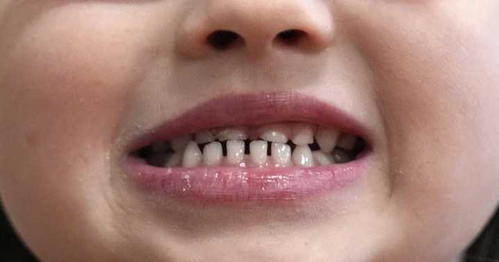 Reguladores en EEUU sopesan eliminar suplementos ingeribles de fluoruro