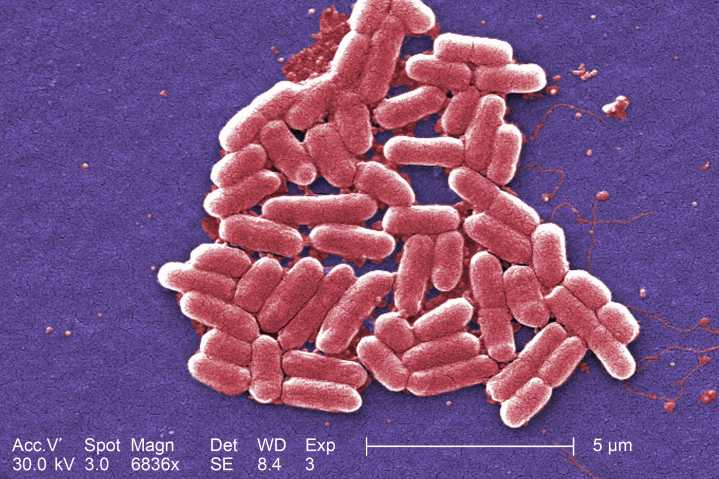 Silencio sobre brote de E. coli destaca cómo los cambios del equipo de Trump debilitan la seguridad alimentaria