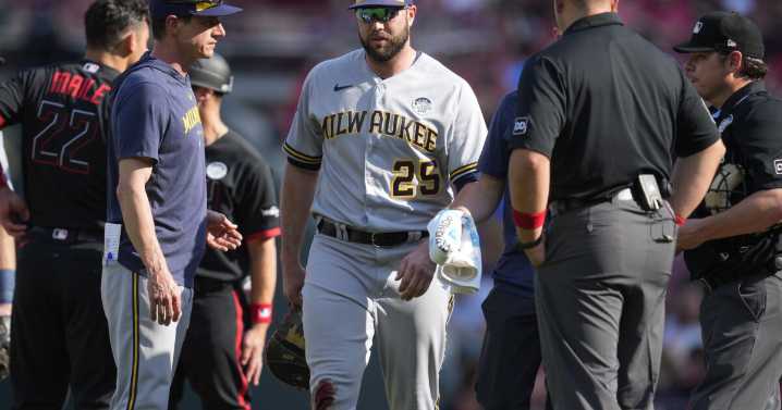 Former MLB player sues Reds after suffering career