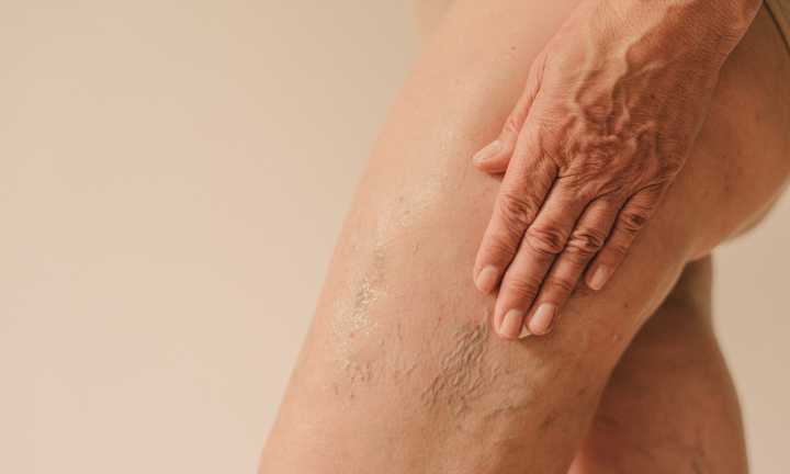 How To Treat & Prevent Crepey Skin Anywhere On The Body
