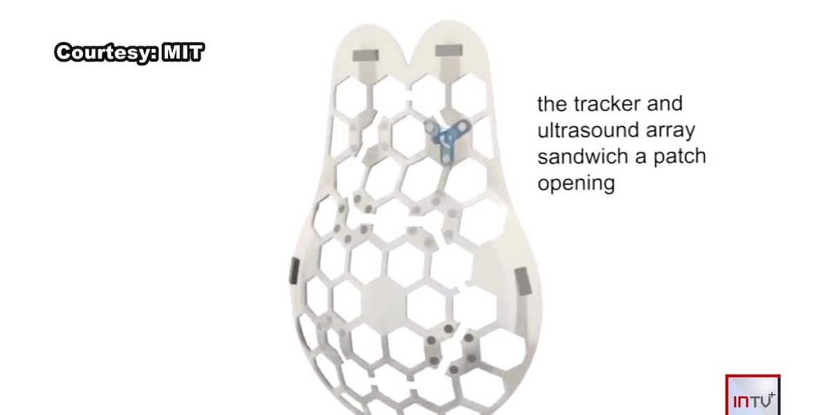 New technology helping to support many battling breast cancer
