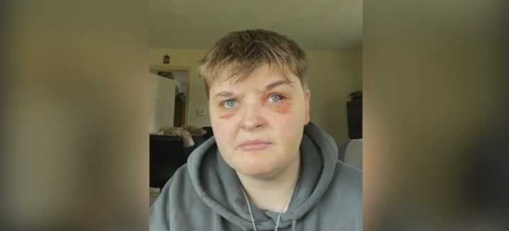 Prosecutors Weigh Hate Crime Charges After Lesbian Woman Beaten at Illinois McDonald’s