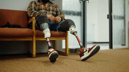 Illinois prosthetics service seeks to help those with limb loss throughout lives