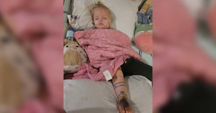 'She's a miracle': Toddler bitten twice by rattlesnake, receives over 30 vials of antivenom