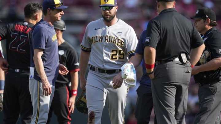 Former MLB player sues Reds over claims of career