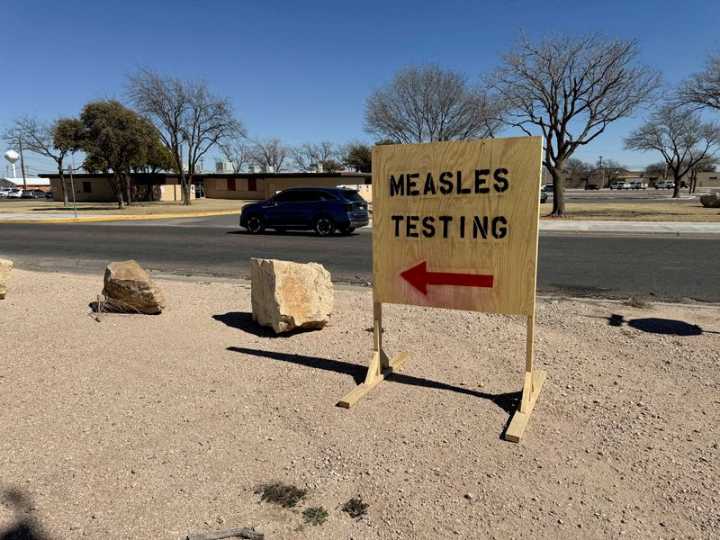 Measles cases in Texas rise by nine to 738, state health department says