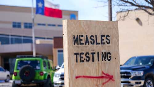 US measles case count climbs slightly to 1,046 cases, while Indiana's outbreak ends, CDC says
