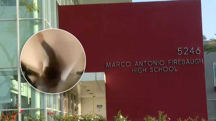 Padre hispano denuncia golpiza a su hijo en escuela de Lynwood y encubrimiento por parte del director