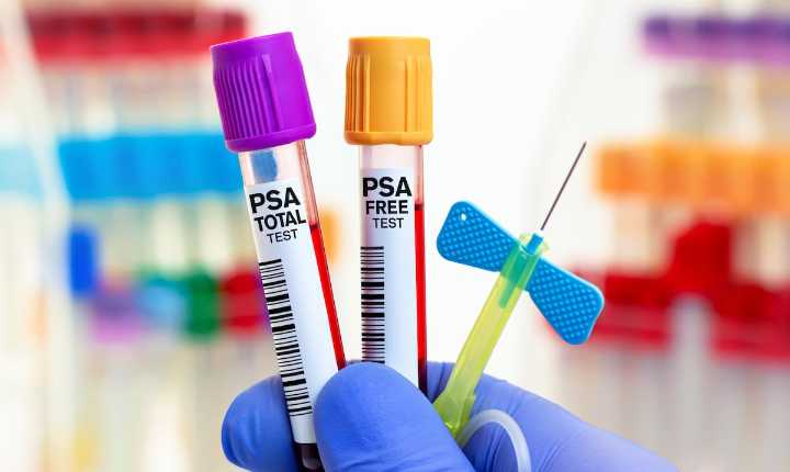 ¿Quiénes deben hacerse la prueba de cáncer de próstata?