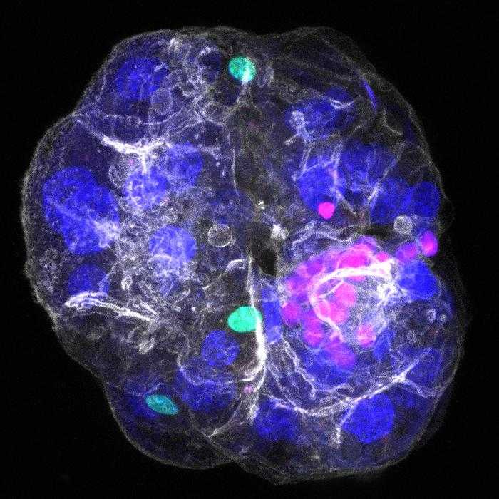 New 3D Liver Organoid Enables the Study of Biliary Fibrosis 