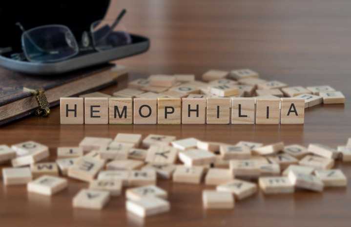Careful Consideration Needed for Management of Acquired (Autoimmune) Hemophilia