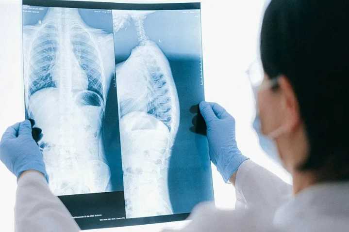 Microplásticos en el cuerpo humano: cómo dañan tus pulmones y sistema inmune, según un nuevo estudio