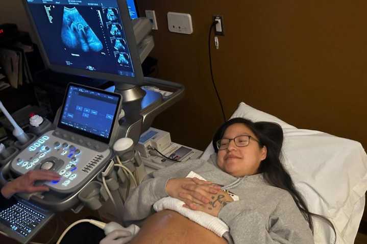 Rural patients face tough choices when their hospitals stop delivering babies