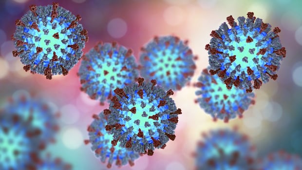Saskatchewan expands measles vaccination to some infants as case numbers rise
