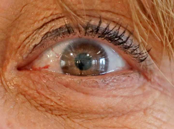 Hong Kong emplea la IA para predecir el riesgo de alzhéimer a través de las retinas