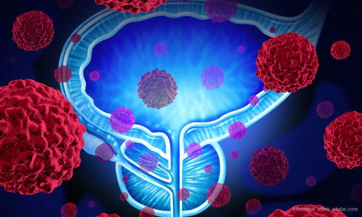 FDA Approved Bayer’s Nubeqa for Metastatic Castration