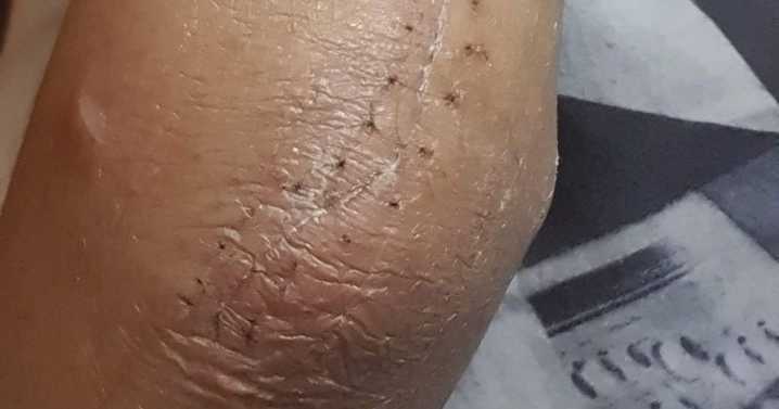 Hospital security guard 'snaps' man's arm during 'illegal' move in dying relative row