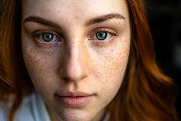 New Report Finds Indiana Ranks Among Worst States for Skin Health