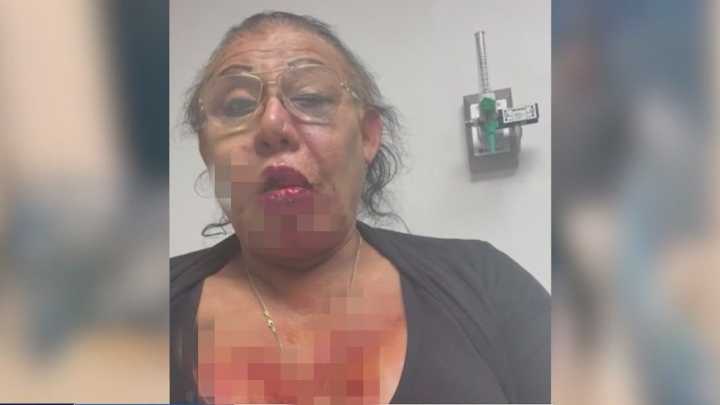 Transgender woman violently attacked for 4th time, allegedly by same 3 suspects: LAPD