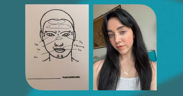 Meet Jeuveau, Botox's Longer-Lasting Competition