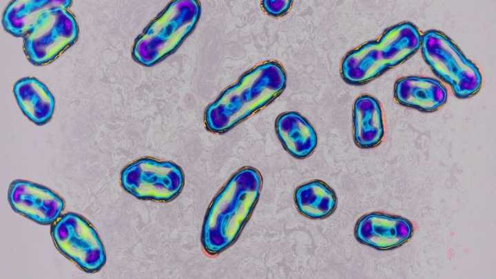 Gene mutation found in the bacterium behind the Black Death helped plague conquer the world, scientists say