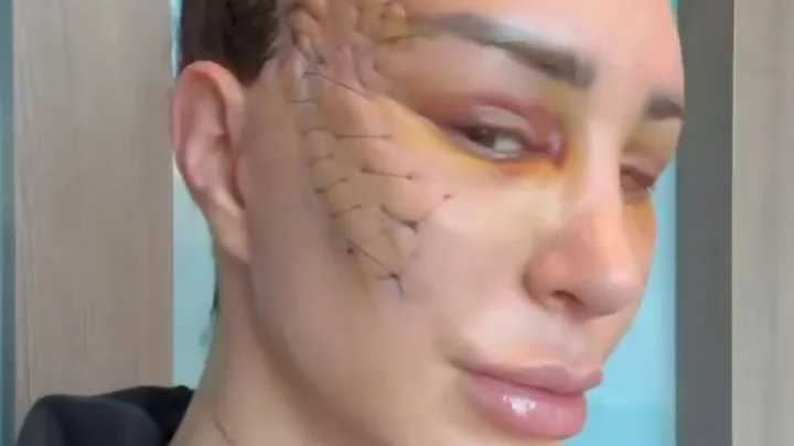 Reality star leaves fans horrified as she reveals result of extreme surgery and they beg her 'get therapy'