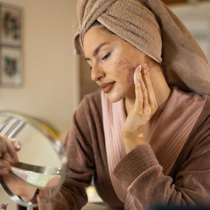 Why You Get Acne on Planes and What Dermatologists Recommend