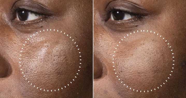 Medik8 unveils 'miracle' new serum that 'defends against premature ageing'