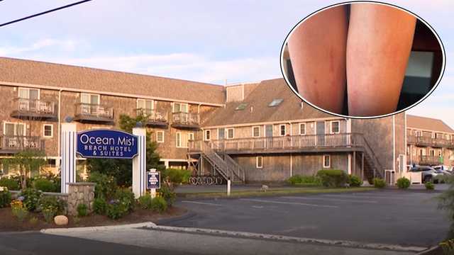 Families say kids got chemical burns from Cape Cod hotel pool, hot tub