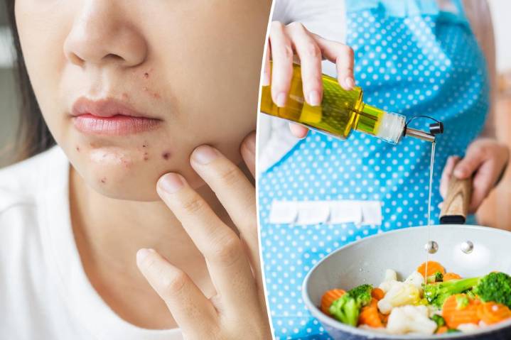 Common cooking mistake could be making you break out