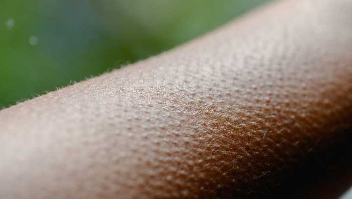 Many Mammals Get Goosebumps, We're Just Not Sure Why Humans Do