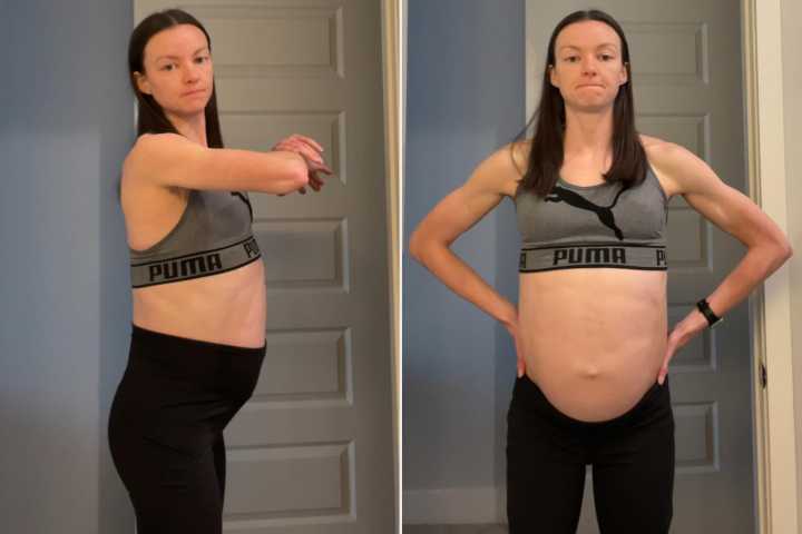 Fitness Trainer Didn’t Go to the Doctor for 7 Years and Had a Huge Cyst (Exclusive)
