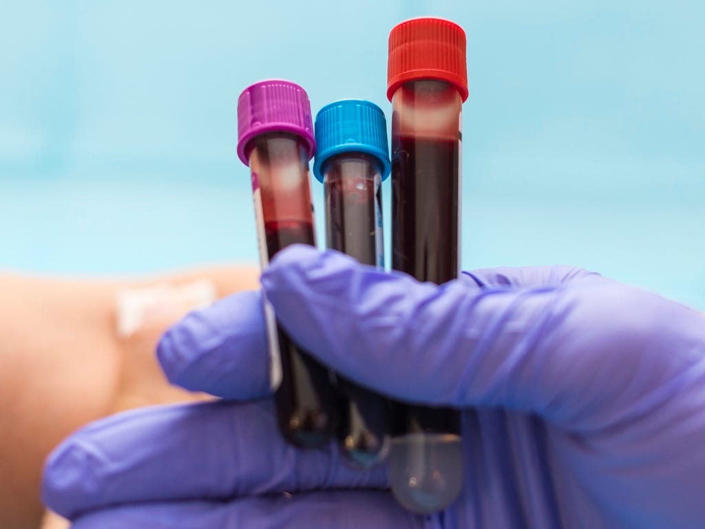 Forget 'biological age' tests — longevity experts are using an $800 under-the-radar blood test to measure aging in real